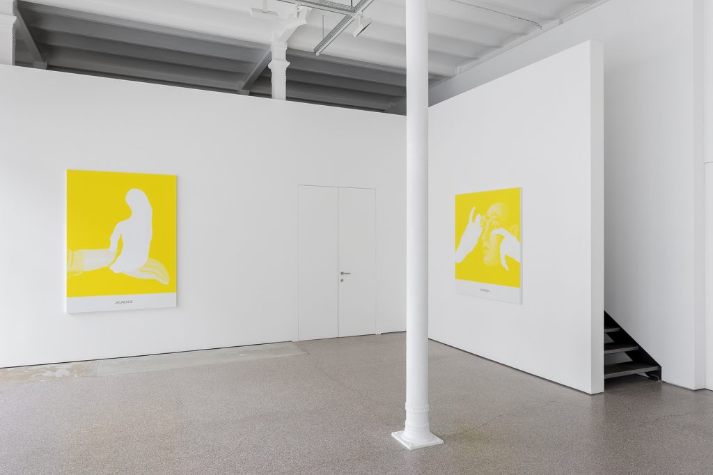 Exhibition View